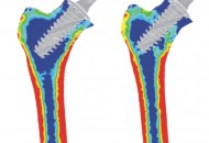 Spiron_bone remodeling