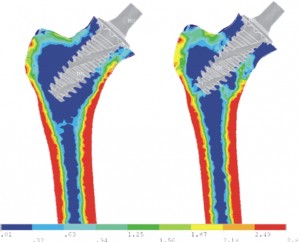 Spiron_bone remodeling