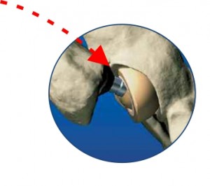 PreCupBC-detail_Corel